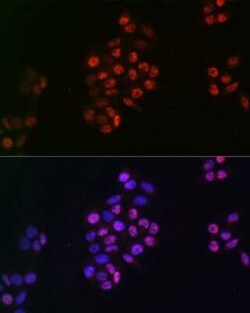 SOX9 Rabbit anti-Human, Mouse, Rat, Clone: 5Y4J8, Novus Biologicals 20 &mu;g | Buy Online | Novus Biologicals | Fisher Scientific