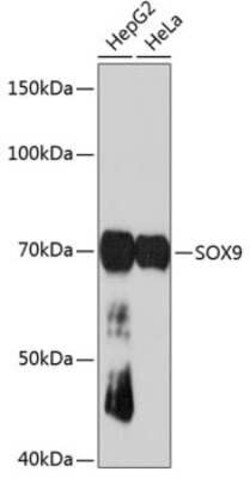 SOX9 Rabbit anti-Human, Mouse, Rat, Clone: 5Y4J8, Novus Biologicals 20 &mu;g | Buy Online | Novus Biologicals | Fisher Scientific