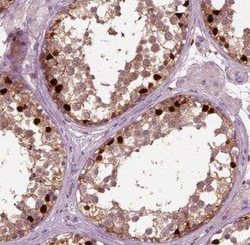 SOX9 Antibody (CL0639), Novus Biologicals:Antibodies:Primary Antibodies