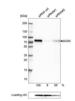 SOX9 Antibody (CL0639), Novus Biologicals 0.1 mL, Unconjugated:Antibodies,