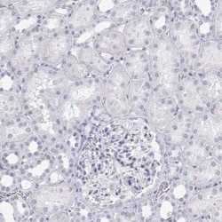 SP-B/Surfactant Protein B Antibody, Novus Biologicals:Antibodies:Primary