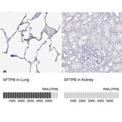 SP-B/Surfactant Protein B Antibody, Novus Biologicals:Antibodies:Primary