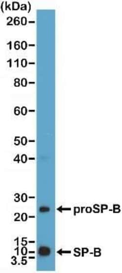 SP-B/Surfactant Protein B Antibody (RM370), Novus Biologicals 100 &mu;g,