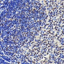 SP1 Rabbit anti-Human, Mouse, Rat, Clone: 5I3A8, Novus Biologicals:Antibodies:Primary