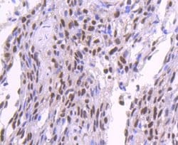SP1 Rabbit anti-Human, Clone: JF0950, Novus Biologicals 100&mu;L:Antibodies,