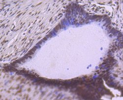 SP1 Rabbit anti-Human, Clone: JF0950, Novus Biologicals 100&mu;L:Antibodies,