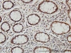 SP1 Antibody (1A5), Novus Biologicals 0.1 mg | Buy Online | Novus Biologicals | Fisher Scientific