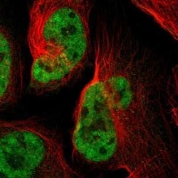 SP1 Antibody, Novus Biologicals 25 &mu;L; Unconjugated:Antibodies, Polyclonal
