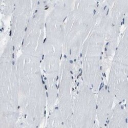 SP1 Antibody, Novus Biologicals 25 &mu;L; Unconjugated:Antibodies, Polyclonal