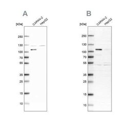 SP1 Antibody, Novus Biologicals 25 &mu;L; Unconjugated:Antibodies, Polyclonal