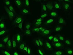 SP100 Antibody, Novus Biologicals 100 &mu;g, Unconjugated:Antibodies