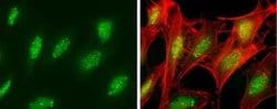 SP100 Antibody, Novus Biologicals 100 &mu;g; Unconjugated:Antibodies, Polyclonal