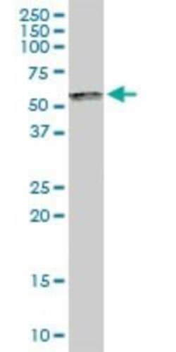 Novus Biologicals SP100 Antibody, Novus Biologicals 0.1 mg | Buy Online | Novus Biologicals&trade; | Fisher Scientific