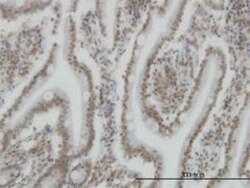 SP110 Antibody (8C8), Novus Biologicals 0.1 mg | Buy Online | Novus Biologicals | Fisher Scientific