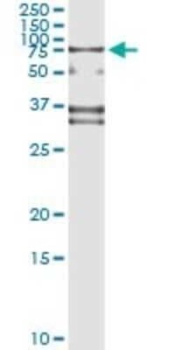 SP110 Antibody (8C8), Novus Biologicals 0.1 mg | Buy Online | Novus Biologicals | Fisher Scientific