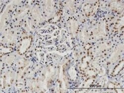SP140 Antibody (3F9), Novus Biologicals 0.1 mg | Buy Online | Novus Biologicals | Fisher Scientific