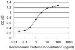 SP17 Antibody (3B6), Novus Biologicals 0.1 mg | Buy Online | Novus Biologicals | Fisher Scientific