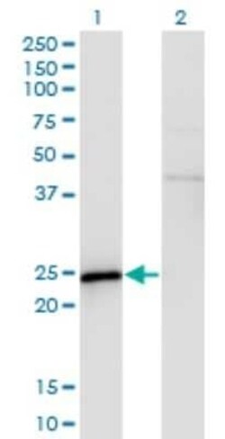 SP17 Antibody (3B6), Novus Biologicals 0.1 mg | Buy Online | Novus Biologicals | Fisher Scientific
