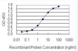 SP2 Antibody (5D3), Novus Biologicals 100 &mu;g | Buy Online | Novus Biologicals | Fisher Scientific