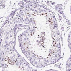 SPACA5 Antibody, Novus Biologicals:Antibodies:Primary Antibodies