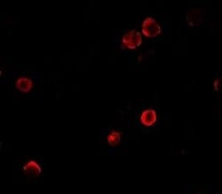 SPACA9 Antibody - BSA Free, Novus Biologicals 0.1 mg; Unconjugated:Antibodies,
