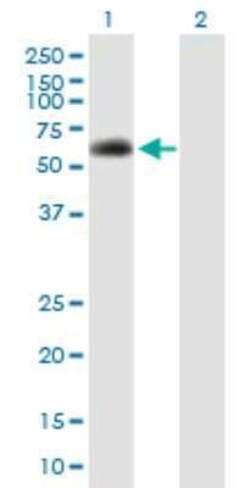 SPAG8 Antibody, Novus Biologicals 50 &mu;g; Unconjugated:Antibodies, Polyclonal