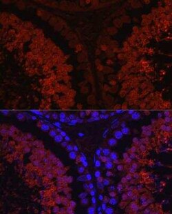 SPAM1 Antibody - Azide and BSA Free, Novus Biologicals 0.02 mL; Unconjugated:Antibodies,