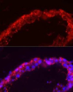 SPAM1 Antibody - Azide and BSA Free, Novus Biologicals 0.02 mL; Unconjugated:Antibodies,