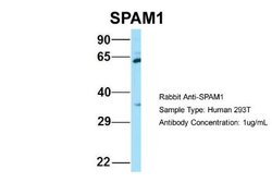 SPAM1 Rabbit anti-Human, Polyclonal, Novus Biologicals 0.1ml; Unconjugated:Antibodies,
