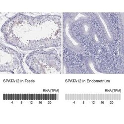 SPATA12 Rabbit anti-Human, Polyclonal, Novus Biologicals 100 &mu;g; Unconjugated:Antibodies,
