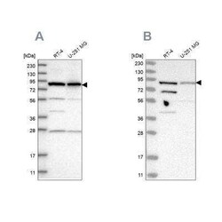 SPATA20 Antibody, Novus Biologicals 0.1 mL; Unconjugated:Antibodies, Polyclonal
