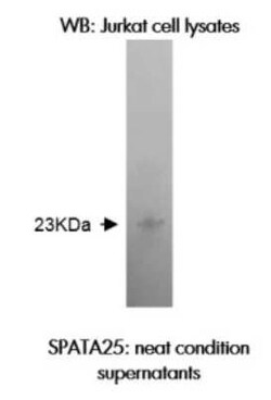 SPATA25 Antibody (Z37P3H11 B2) - BSA Free, Novus Biologicals 0.1 mL, Unconjugated:Antibodies,