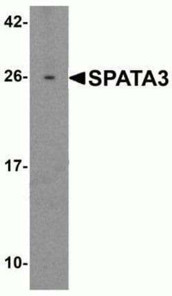 SPATA3 Antibody - BSA Free, Novus Biologicals 0.1 mg | Buy Online | Novus Biologicals | Fisher Scientific