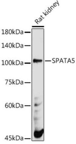SPATA5 Rabbit anti-Human, Mouse, Rat, Polyclonal, Novus Biologicals 20