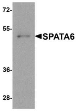 SPATA6 Antibody - BSA Free, Novus Biologicals 0.1 mg | Buy Online | Novus Biologicals | Fisher Scientific