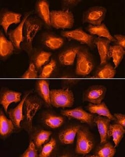 SPC18 Antibody - Azide and BSA Free, Novus Biologicals 0.02 mL; Unconjugated:Antibodies,