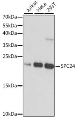 SPC24 Antibody - Azide and BSA Free, Novus Biologicals 0.02 mL; Unconjugated:Antibodies,