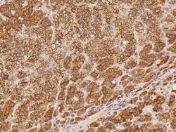 SPDYC Antibody, Novus Biologicals 100 &mu;g | Buy Online | Novus Biologicals | Fisher Scientific