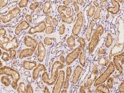 SPDYC Antibody, Novus Biologicals 100 &mu;g | Buy Online | Novus Biologicals | Fisher Scientific