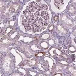 SPECC1L Antibody, Novus Biologicals:Antibodies:Primary Antibodies