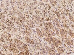 SPECC1L Antibody, Novus Biologicals 50 &mu;g | Buy Online | Novus Biologicals | Fisher Scientific