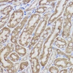 SPFH2 Rabbit anti-Human, Mouse, Rat, Clone: 9T3M5, Novus Biologicals:Antibodies:Primary