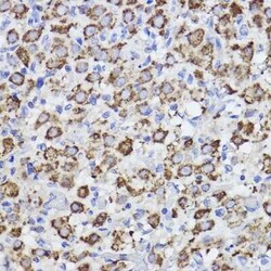 SPFH2 Rabbit anti-Human, Mouse, Rat, Clone: 9T3M5, Novus Biologicals:Antibodies:Primary