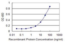 Novus Biologicals SPG21 Antibody (2B11), Novus Biologicals 0.1 mg | Buy Online | Novus Biologicals&trade; | Fisher Scientific