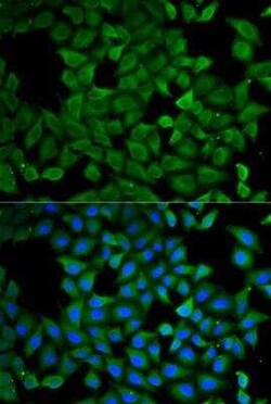 SPG3A Antibody - BSA Free, Novus Biologicals 0.1 mL; Unconjugated:Antibodies,