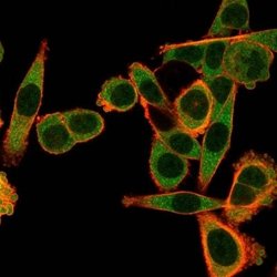 SPIC Mouse anti-Human, Clone: PCRP-SPIC-2C5, Novus Biologicals:Antibodies:Primary