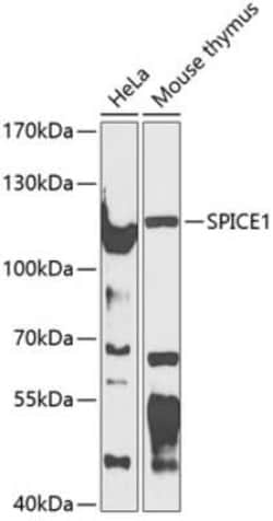 SPICE1 Antibody - BSA Free, Novus Biologicals 0.1 mL, Unconjugated:Antibodies,