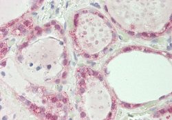 SPIN1 Rabbit anti-Human, Polyclonal, Novus Biologicals 0.1 mL | Buy Online | Novus Biologicals | Fisher Scientific