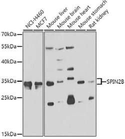 SPIN2B Antibody - BSA Free, Novus Biologicals 0.1 mL, Unconjugated:Antibodies,
