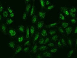 SPIN4 Antibody, Novus Biologicals 100 &mu;g, Unconjugated:Antibodies, Polyclonal